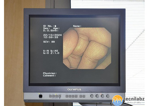 Colonne d'endoscopie Olympus 260 - 3/4