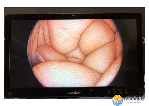 Colonne d'endoscopie Stryker 1688 - 4/4