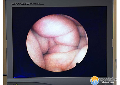 Uretéroscope Olympus - 4/5