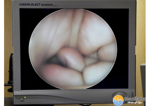 Uretéroscope Storz - 5/5